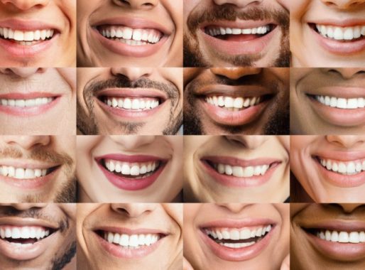 Cosmetische tandheelkunde